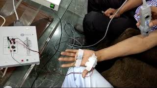 EMG test demonstration  Electromyography EMG [upl. by Brelje479]