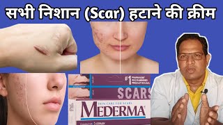 mederma cream  Mederma for acne scars  Mederma Advanced scar gel review [upl. by Machutte452]