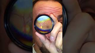 How to Do Your Own Fundus Exam [upl. by Notsecnirp]