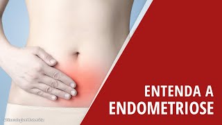 Entenda a Endometriose [upl. by Dnalsor943]