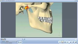 Anterior Guidance [upl. by Averill]