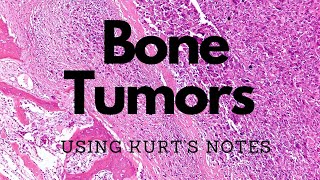 Bone Tumors Kurt’s Notes pathagonia [upl. by Rosenkranz804]