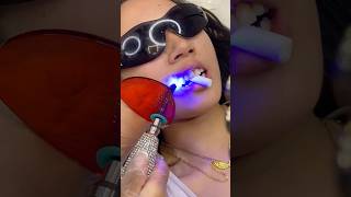 Would you get this star tooth gem toothgems toothgem toothgemtutorial toothgemtechnician viral [upl. by Belak477]