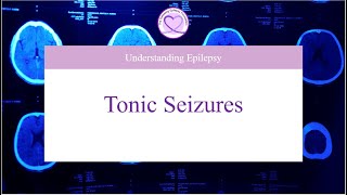 What are Tonic Seizures [upl. by Hoffman650]