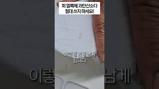 오래된 피 얼룩 제거하는 법 과탄산소다 먼저 절대 쓰지 마세요 [upl. by Abbub]