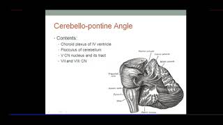 Brainstem PONS Clinical Anatomy Millard Gubler Syndrome Pontine Haemorrhage By Dr Azmi Mohsin [upl. by Haisoj928]