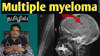 multiple myeloma in tamilmedical awareness in tamil [upl. by Roz]