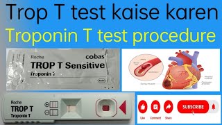 Trop T test kaise karen  Troponin T test procedure  Trop T blood test kaise kare [upl. by Tuinenga]