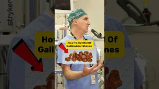 How to get rid of gallbladder stones shorts [upl. by Graig]