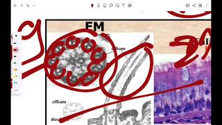 cytoskeletonampinclusion [upl. by Hull]