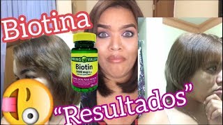 BIOTINA  Resultados Historia de mi transición Lismi Rodríguez 💜 [upl. by Emyam]