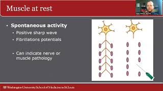 Basics of Electrodiagnostic Testing – Nate Olafsen MD [upl. by Munt287]