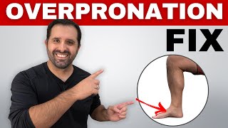 4 Exercises To Correct Overpronation In Runners To Prevent Injury [upl. by Intirb600]