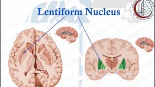 Brain Anatomy 13 Basal Ganglia 2 Lentiform NucleusInternal CapsuleClaustrum [upl. by Salkcin]