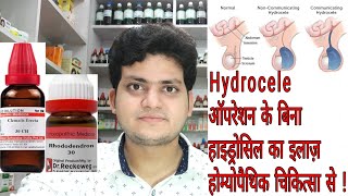 Homoeopathic Medicine for hair fall treatment [upl. by Ordnasela150]