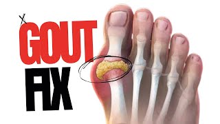 Gout Relief Natural Solution [upl. by Aneekat]