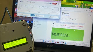 EMG BIOSENSOR BY USING ESP32 WITH IOT APPLICATION FOR ATHLETES [upl. by Ginder]