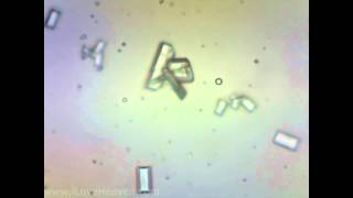 Feline Urine Sample with Struvite Crystals 4 Microscope Camera [upl. by Christophe]