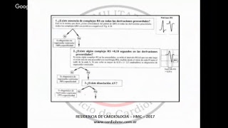 ARRITMIA VENTRICULAR Y CRITERIOS DE BRUGADA [upl. by Repsaj]