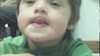 Dariens Journey with Childhood Apraxia of Speech [upl. by Birecree]