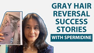 Gray Hair Reversal Success Stories with Spermidine [upl. by Atiloj633]