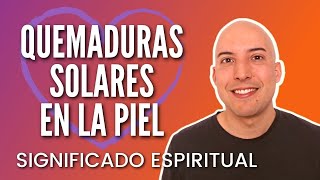 🔥QUEMADURAS SOLARES en la piel Significado espiritual  por Manuel Requena [upl. by Cinemod]