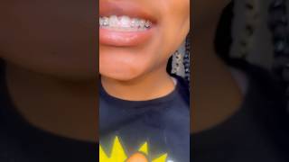 Teeth gems so fun gemzeez [upl. by Antonie]