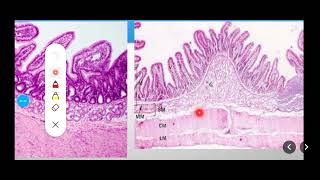 Histology Slides Series Episode 10  Histology of the Small Intestine Duodenum Jejunum Ileum [upl. by Encrata399]