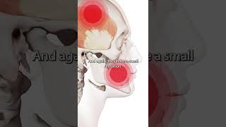 Temporalis Muscle Trigger Points [upl. by Bethanne82]