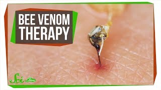 The Problem with Bee Venom Therapy [upl. by Doloritas]