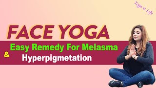 Face Yoga  Easy Remendy For Melasma and Hyperpigmetation  Yoga is Life yoga yogaislife [upl. by Uri]