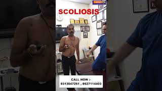 Chiropractic treatment in Udaipur  Scoliosis  Dr Varun Chiropractor  Call now  9313047251 [upl. by Nauq134]