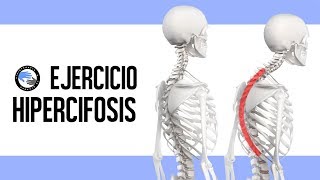 Ejercicio para la hipercifosis dorsal joroba o chepa [upl. by Oza]