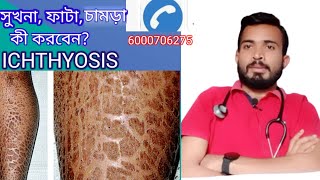 Ichthyosis causesymptom and treatment Fish Scale Diseasein Bangla [upl. by Nuri]