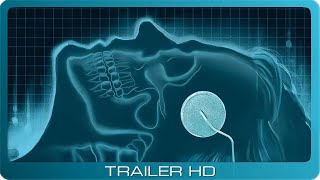 Flatliners 1990  Trailer [upl. by Haskins271]