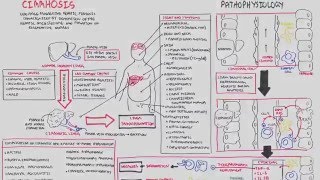 Liver Cirrhosis SandS Pathophysiology Investigations Management [upl. by Arie]