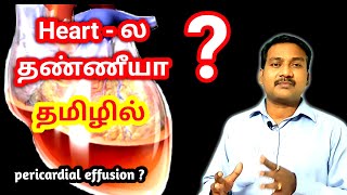 Pericardial Effusion in tamil  Heart Problem in tamil  ECG ECHO in tamil [upl. by Leahcimaj]