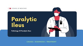 Causes Of Paralytic Ileus  Diagnosis  Treatment [upl. by Nahshun]