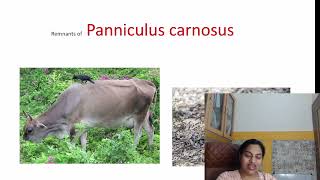 Panniculus Carnosus Remnants [upl. by Anier278]