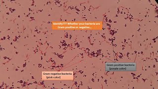 Gram positive and Gram negative bacterial slides under the Microscope [upl. by Herod]