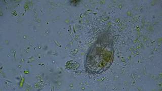 Bacteria are Eating a Dead Rotifer [upl. by Idelle]