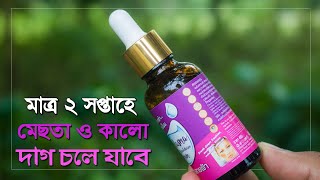 ২ সপ্তাহে মেছতার দাগ দূর করার সিরাম  মেছতা দূর করার ক্রিম Melasma Breakdown Serum [upl. by Reinhold271]