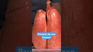 Poumon de fumeur VS non fumeur [upl. by Holli394]