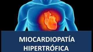 Miocardiopatía Hipertrófica  Fisiopatología [upl. by Ettenaej]