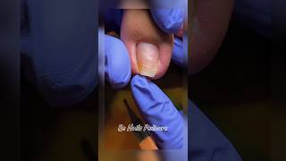 Nails satisfying pedicure shorts nails pedicure satisfying [upl. by Eintihw]