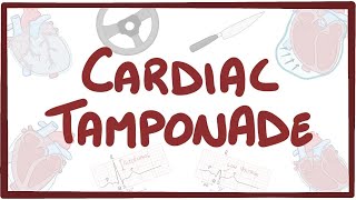 Cardiac tamponade  causes symptoms diagnosis treatment pathology [upl. by Ardelia854]