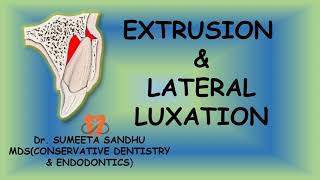 Extrusion and lateral luxation of teeth  Management Luxation injuries [upl. by Inva]