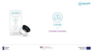 Lungs auscultation  coarse crackles 1 [upl. by Pazit]