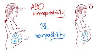 ABO incompatibility vs Rh incompatibility [upl. by Egroeg]