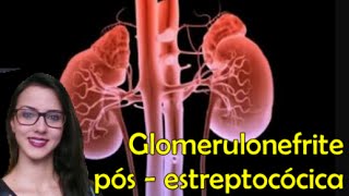 Glomerulonefrite Pós  Estreptocócica [upl. by Lebasi214]